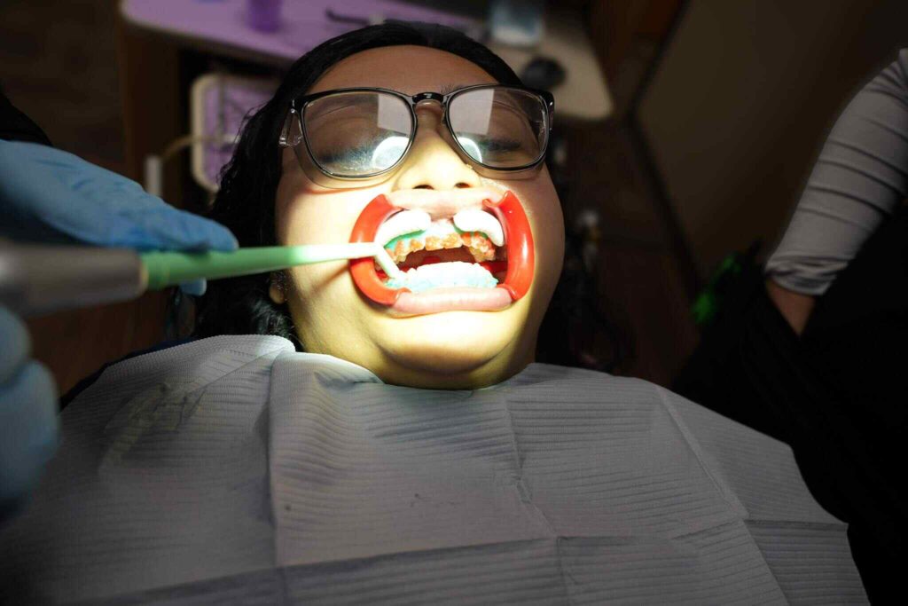 Cosmetic Dentist Near Me in Montgomery, Lady receiving professional teeth whitening service at dentist