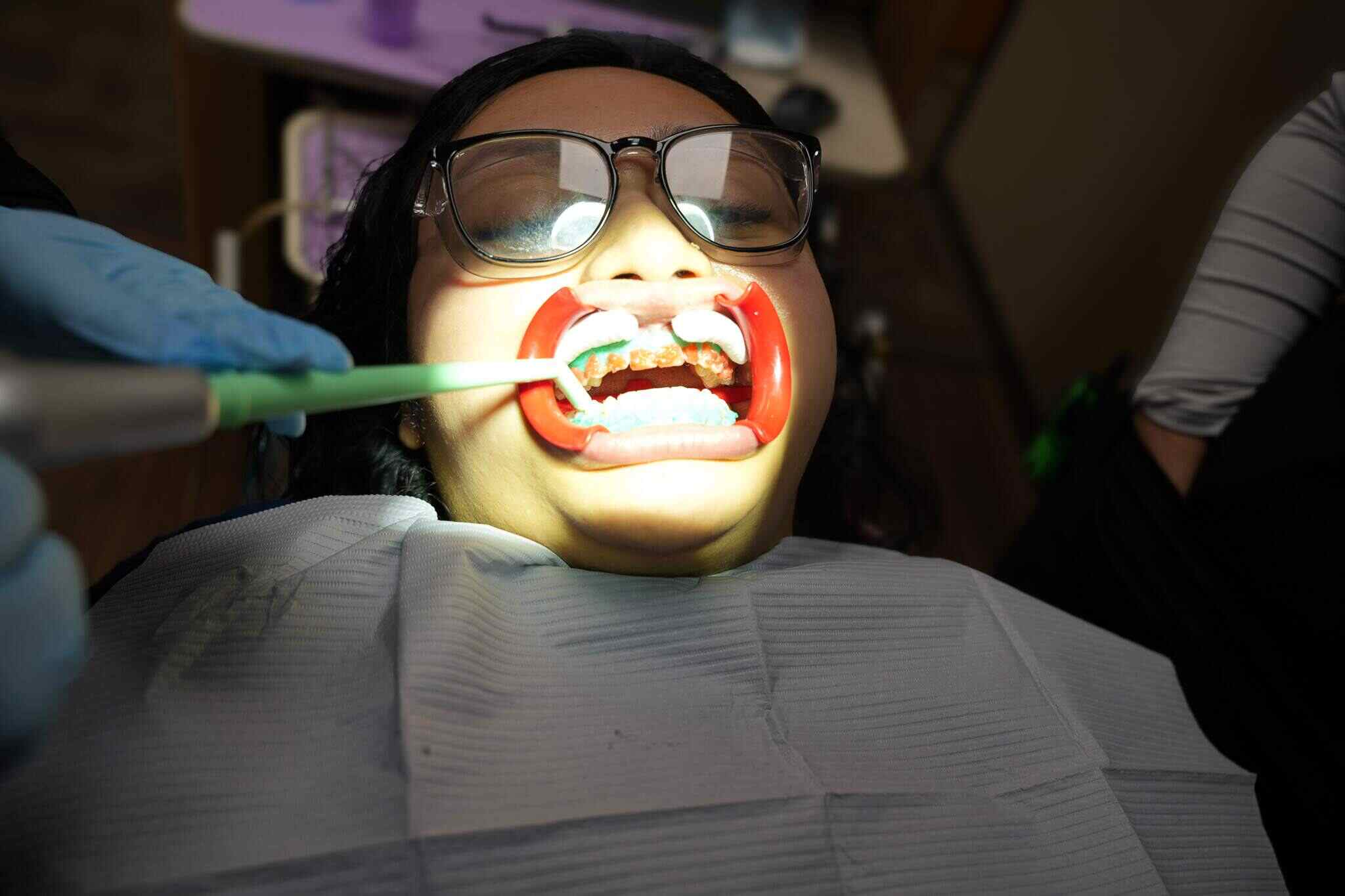 Cosmetic Dentist Near Me in Montgomery, Lady receiving professional teeth whitening service at dentist