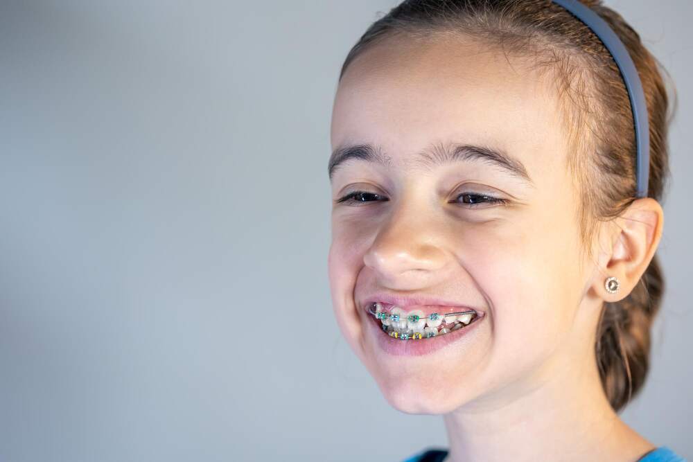 Braces for kids in Romeoville, when should you start? Little girl smiling with braces