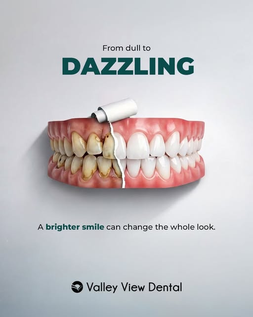 A brighter smile can make a bigger difference than you think - Valley View Dental